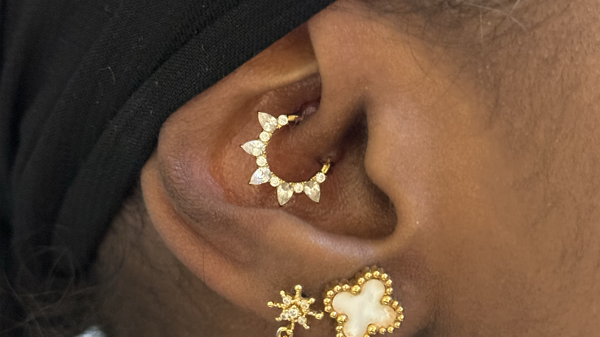 Piercing che non guarisce