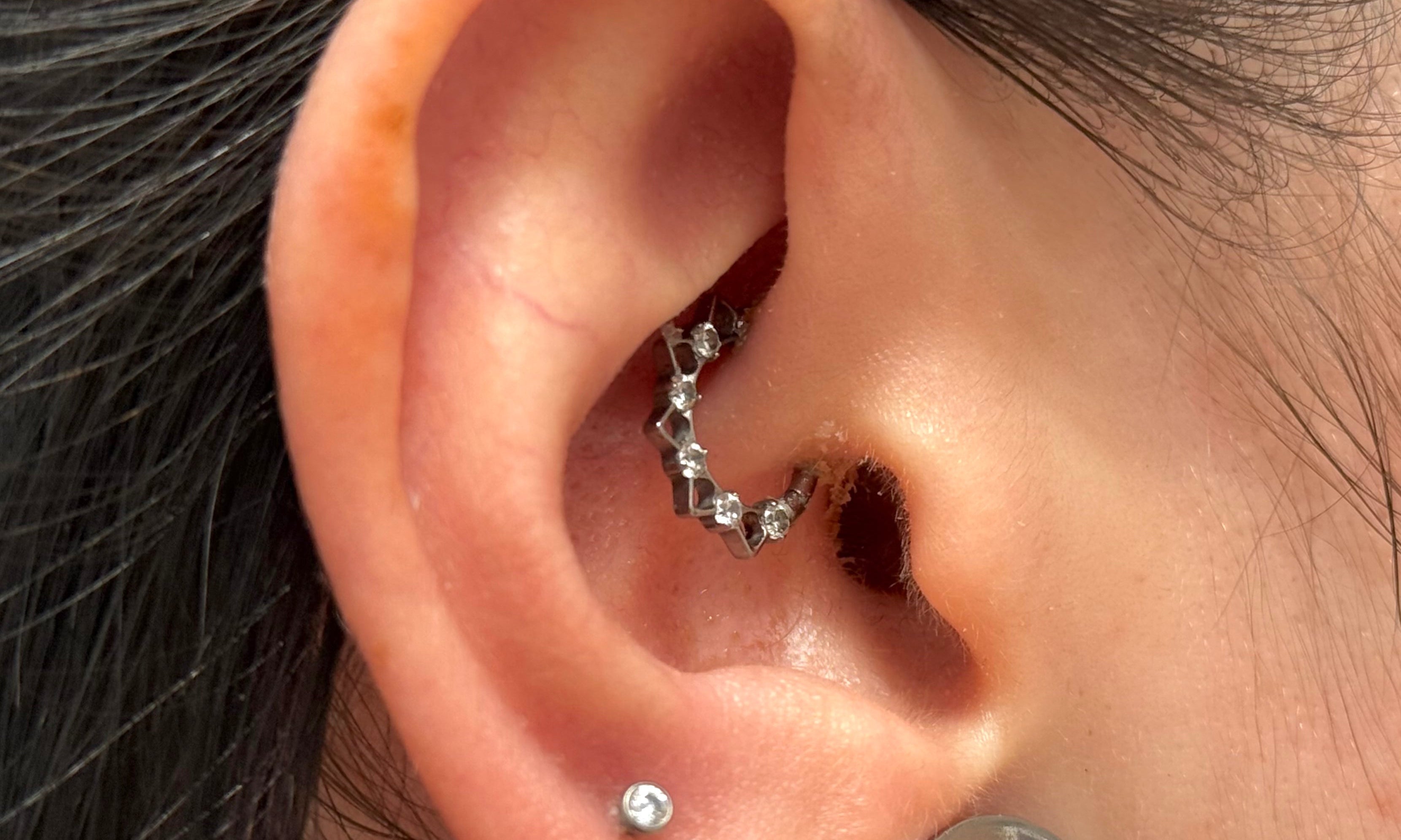 Perché il mio piercing fa croste anche dopo anni?