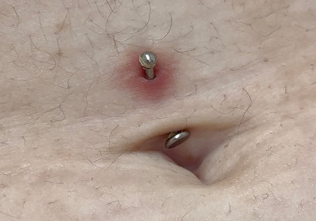 Ho una macchia scura attorno al piercing!