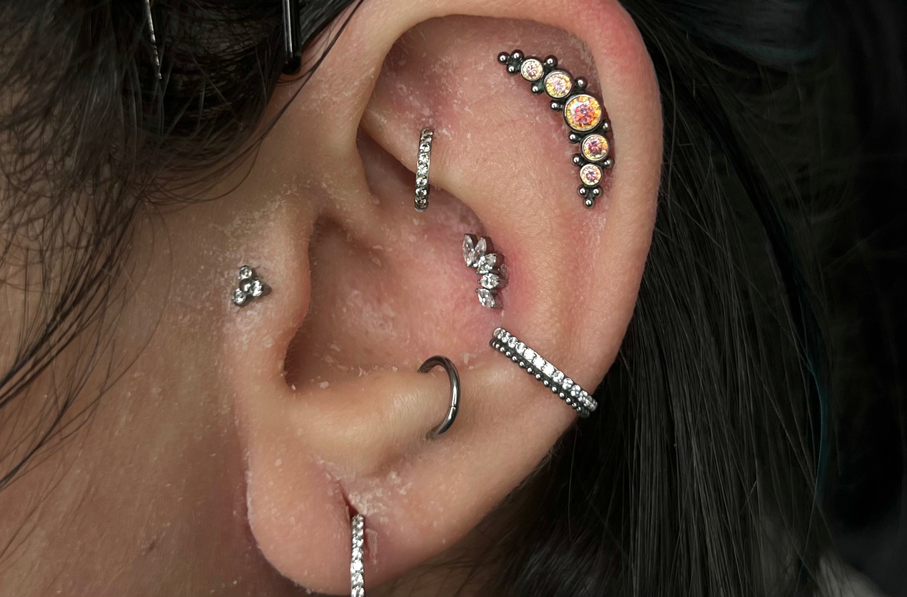 Dermatite e piercing